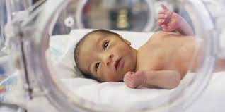 Breastfeeding the Premature Baby: Nursing in the NICU